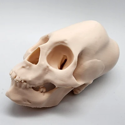 Hộp Sọ Người Peru Nữ Bị Bó Chặt