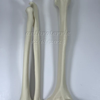 Xương Cánh Tay Trái