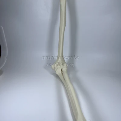 Xương Cánh Tay Trái