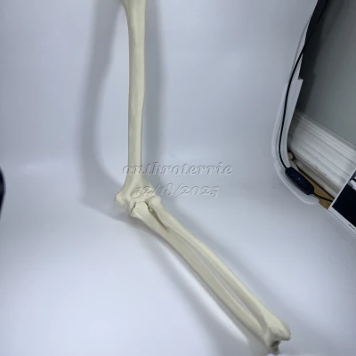 Xương Cánh Tay Trái