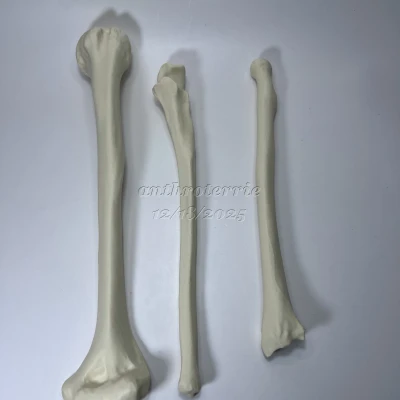 Xương Cánh Tay Trái