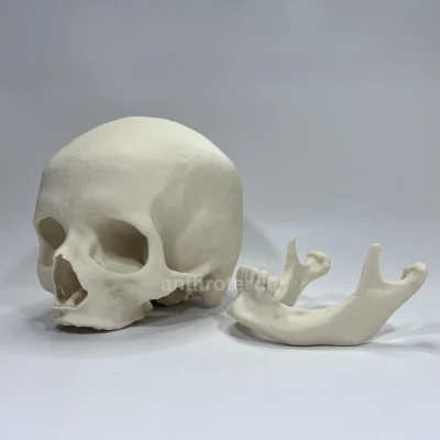 Hộp Sọ và Hàm Dưới Nữ Giới Nhìn Thấy