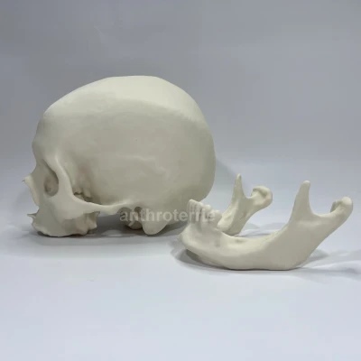 Hộp Sọ và Hàm Dưới Nữ Giới Nhìn Thấy