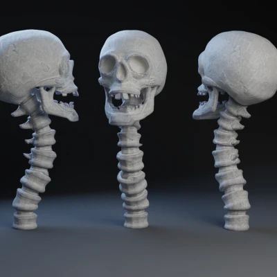 Đầu Lâu và Cột Sống Toff / Chóp Gậy