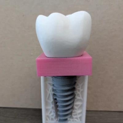 Mô Hình Giáo Dục Bệnh Nhân Cấy Ghép Keon / Giải Trí Cho Nha Sĩ
