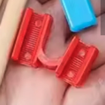 Kẹp đũa Trung Quốc (Chinese chopsticks clip)